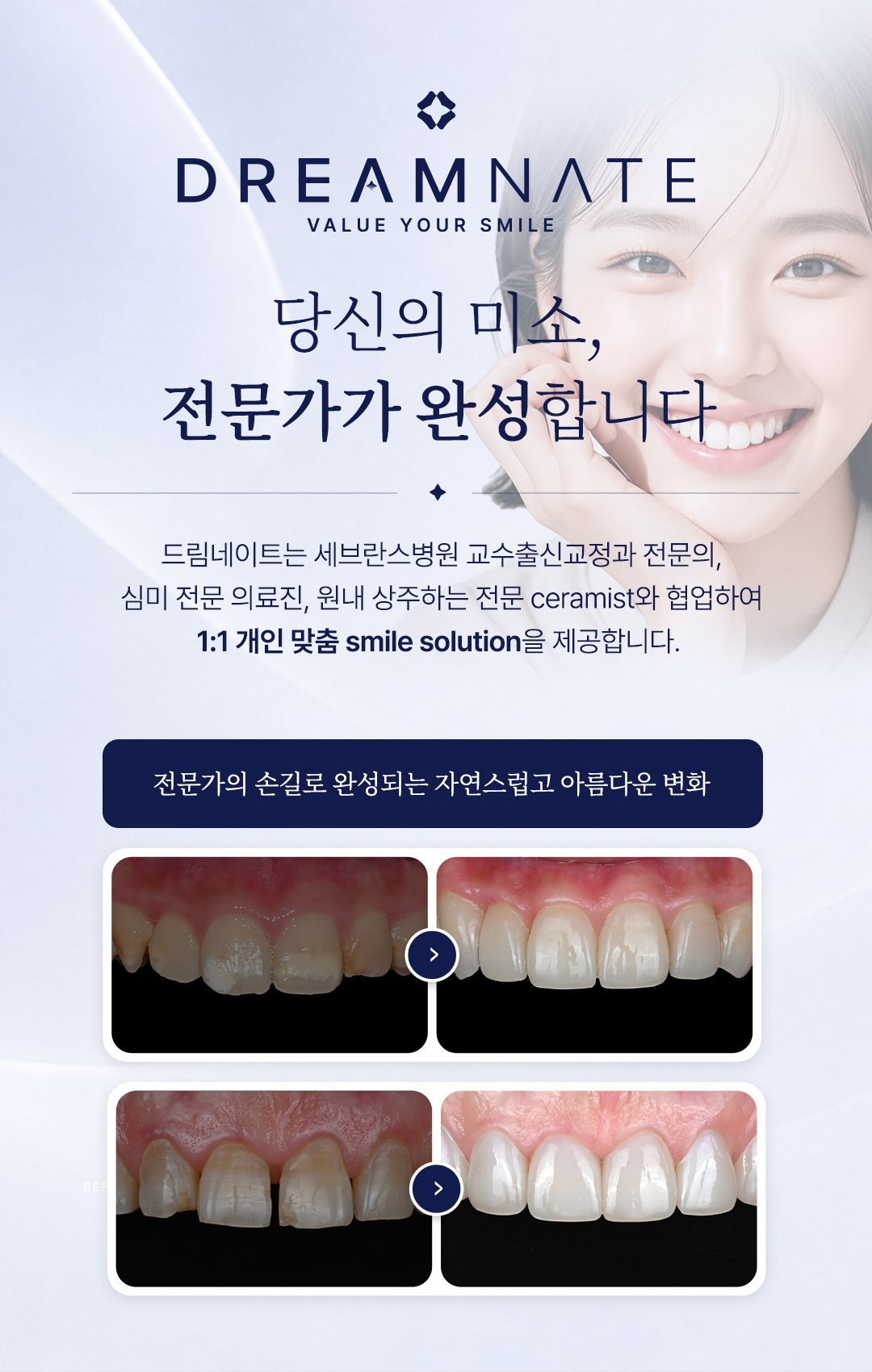 강동구 치과 연세꿈꾸는치과 대표 진료