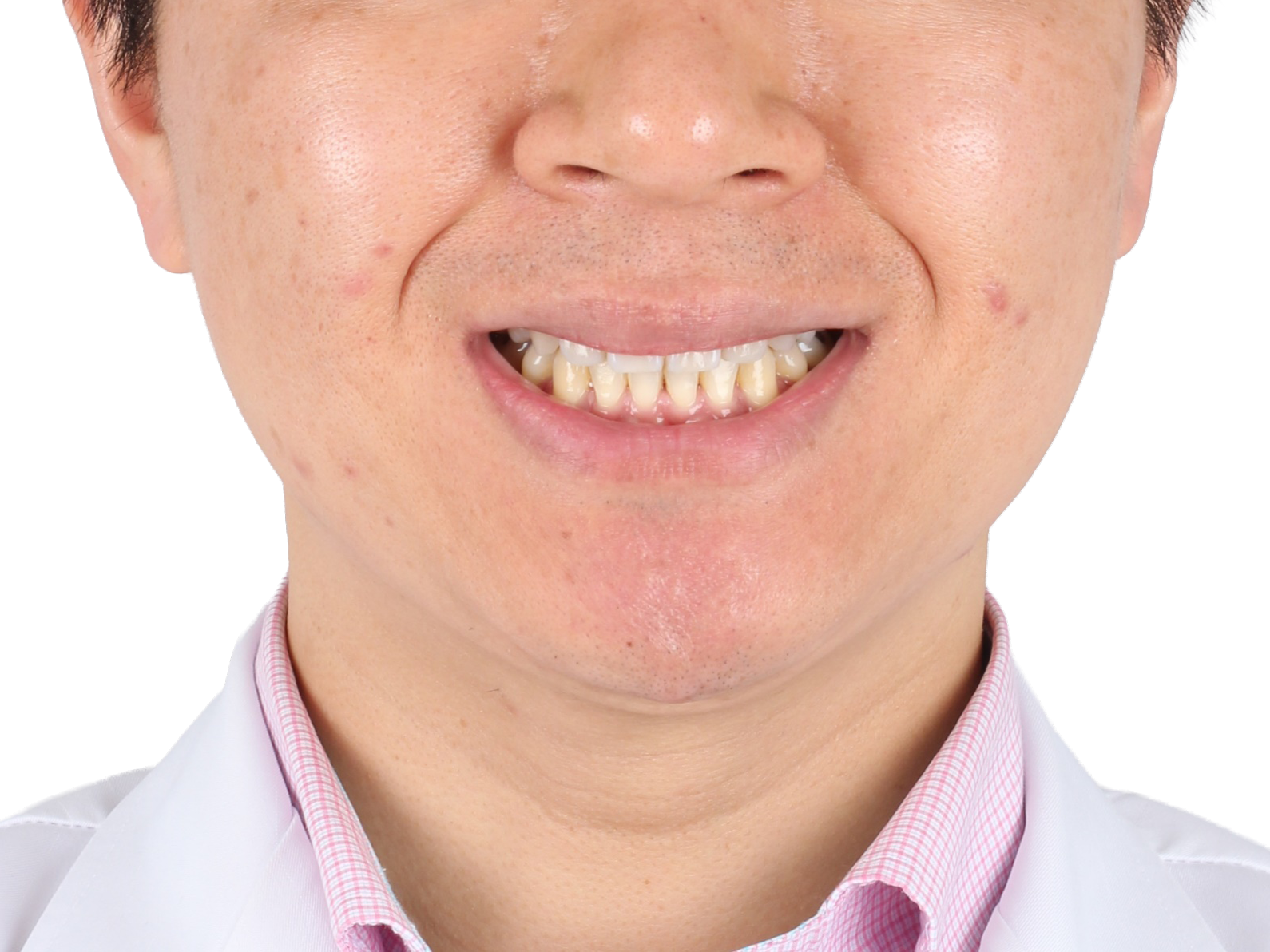 중심선 · 비대칭 사례 03 얼굴 정면 치료 후